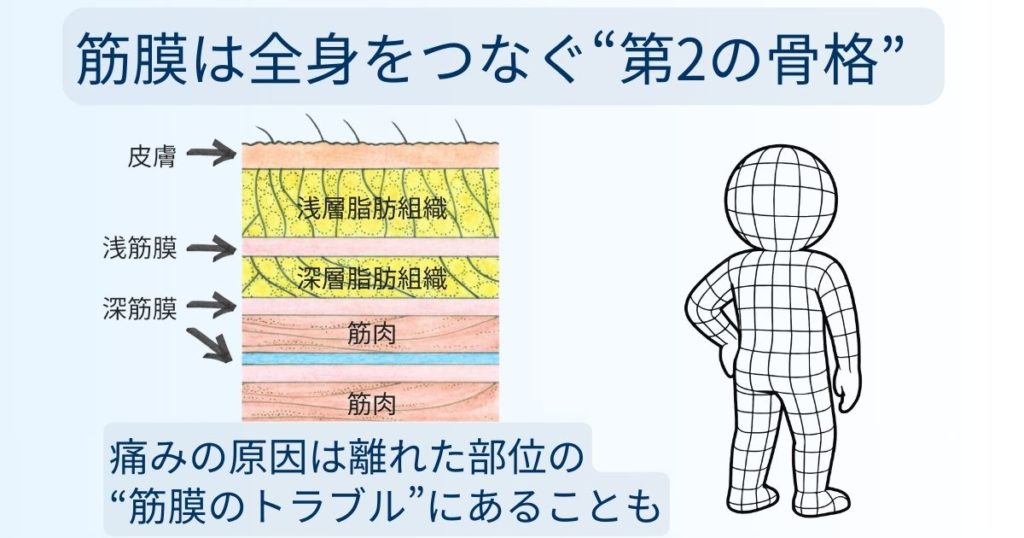 痛みの原因となる筋膜の癒着・滑走不全を解説する図解