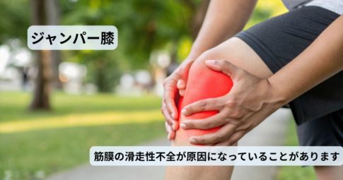松阪市でジャンパー膝・膝のお皿の下の痛みに悩む方へ。理学療法士による筋膜整体でスポーツ復帰を目指すネクストパフォーマンス