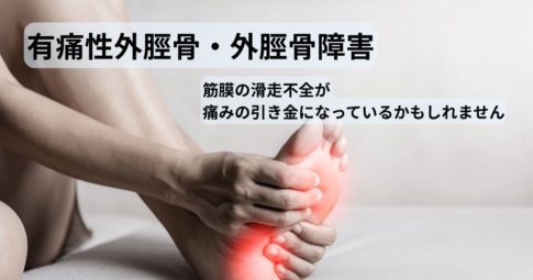 松阪市で有痛性外脛骨・足の内側の骨の出っ張りの痛みに悩む方へ。理学療法士による筋膜整体で改善を目指すネクストパフォーマンス